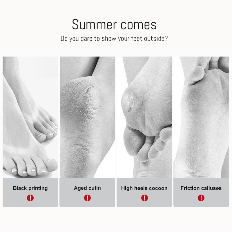 Foot Mask That Peels Skin factory Foot Mask That Peels Skin factory