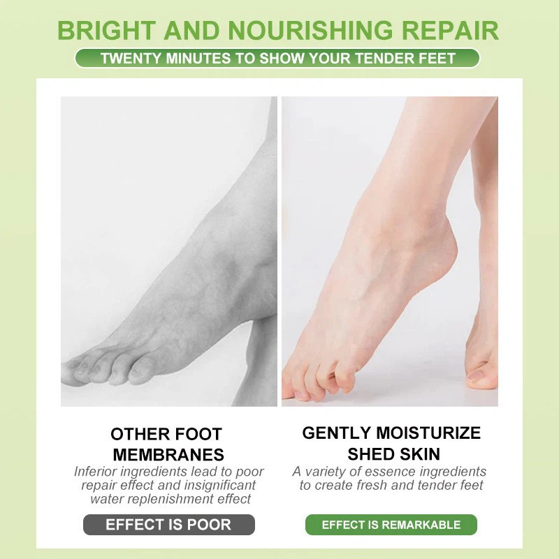 Foot Mask That Peels Skin best Foot Mask That Peels Skin best